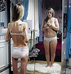an underweight woman perceives herself as overweight
